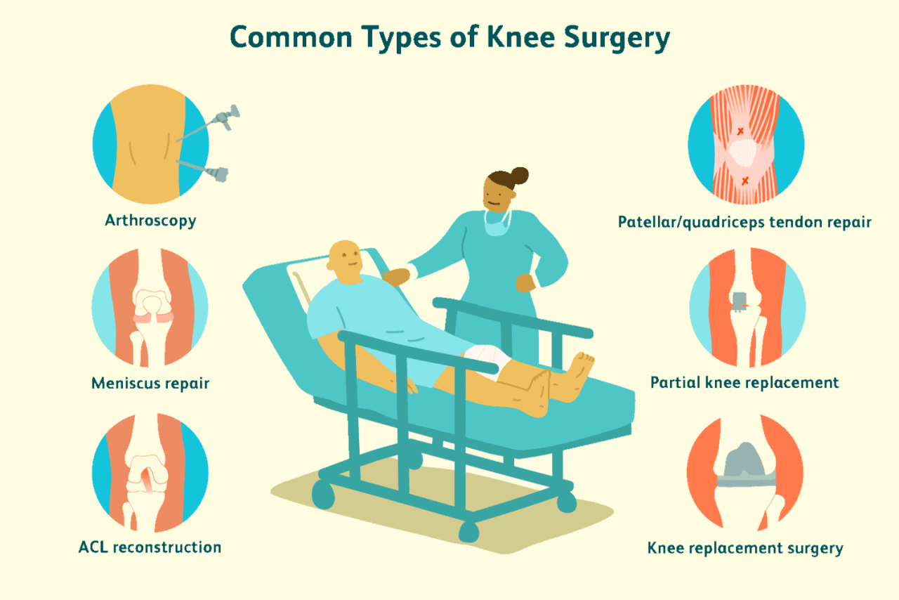 Health Knee Pain and Surgery